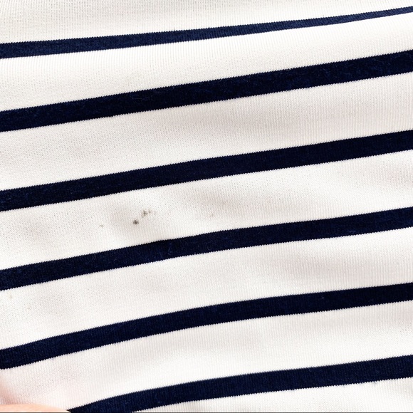 HYFVE Oversized Striped Tunic Dress - Picture 6 of 6